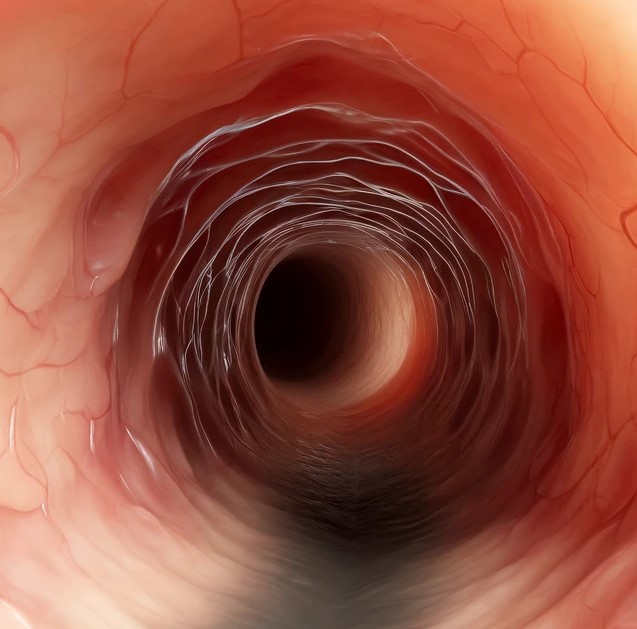 AI generated image of an oesophagus affected by eosinophilic oesophagitis