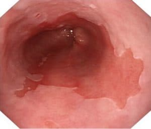 The London Gastroenterology Centre, endoscopies, gastrointestinal disorders., colonoscopies, and gastrointestinal treatment